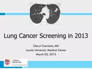 Lung Cancer Screening in 2013