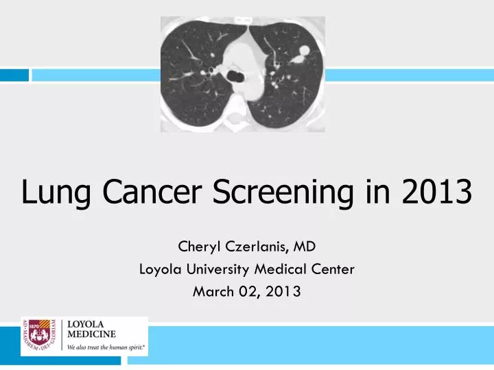lung cancer screening in 2013