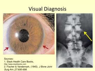 Visual Diagnosis