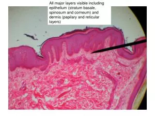 Close-up of epidermis