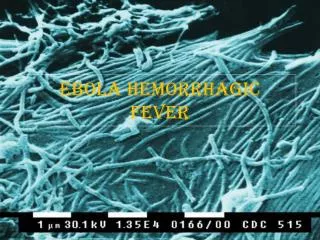 Ebola Hemorrhagic Fever