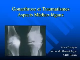 gonarthrose et traumatismes aspects m dico l gaux
