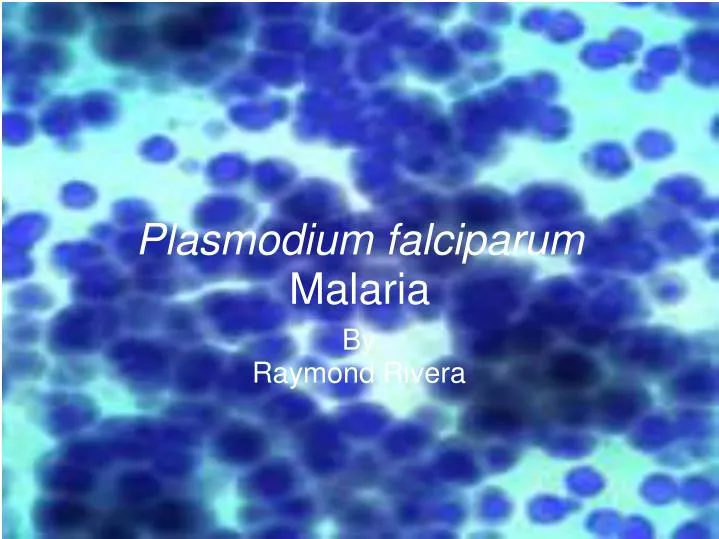 plasmodium falciparum malaria