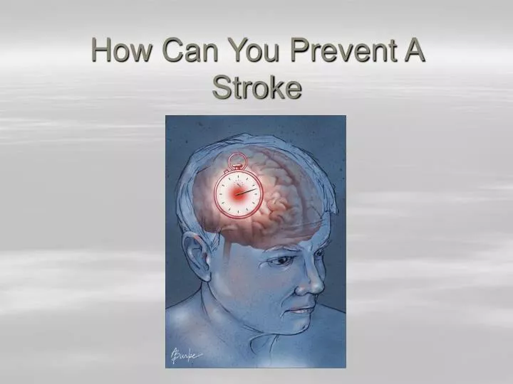 how can you prevent a stroke