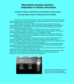 Myometrial caveolae and their 			implication in uterine contraction