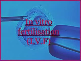 In vitro fertilisation (I.V.F)