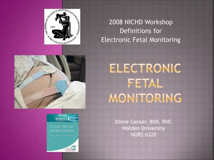 electronic fetal monitoring