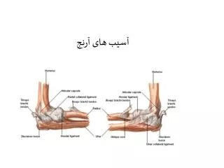 آسیب های آرنج