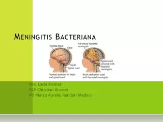 meningitis bacteriana