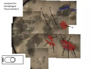 Liverpool Uni Oesophageal Tissue Sample E