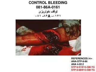 CONTROL BLEEDING 081-86A-0161 توقف خونریزی ۰۱۶۱- A ۸۶- ۰۸۱
