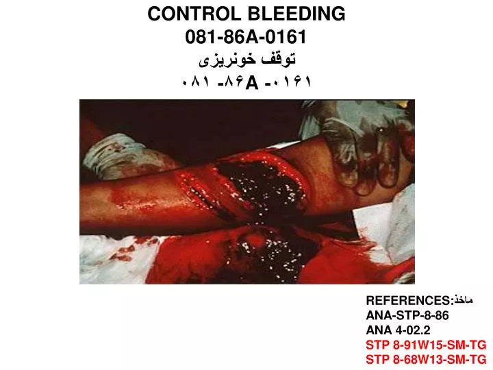 control bleeding 081 86a 0161 a
