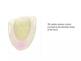 3D cardiac motion vectors overlaid on the diastolic frame of the heart.