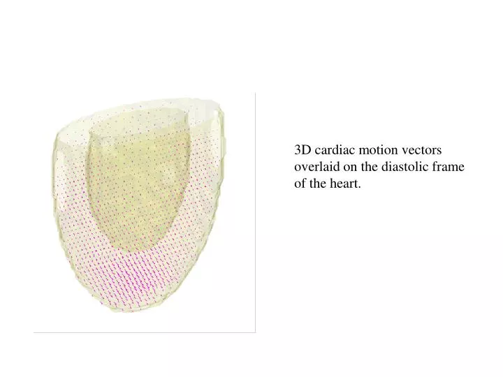 3d cardiac motion vectors overlaid on the diastolic frame of the heart