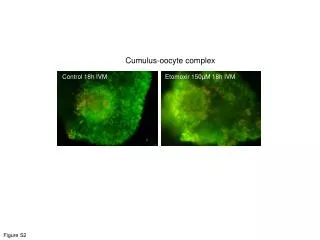 Cumulus-oocyte complex