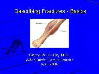 Describing Fractures - Basics