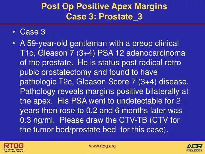 post op positive apex margins case 3 prostate 3