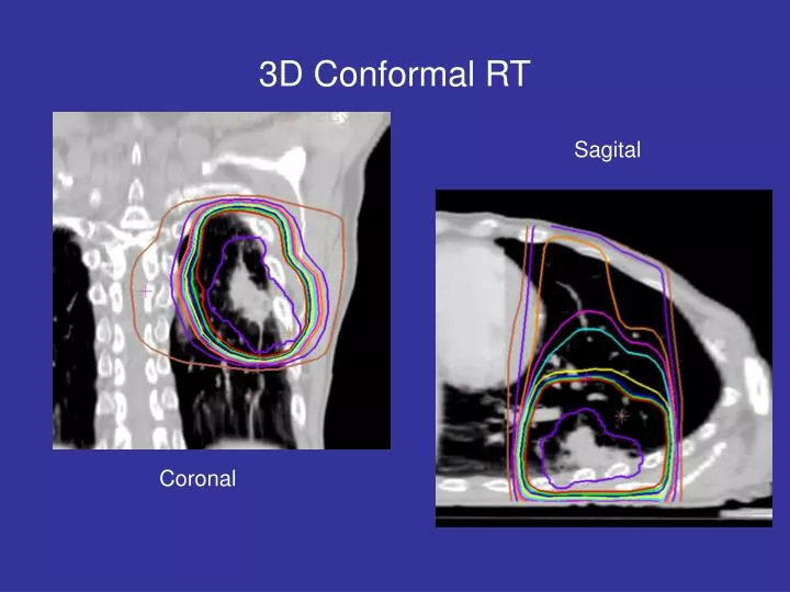 3d conformal rt