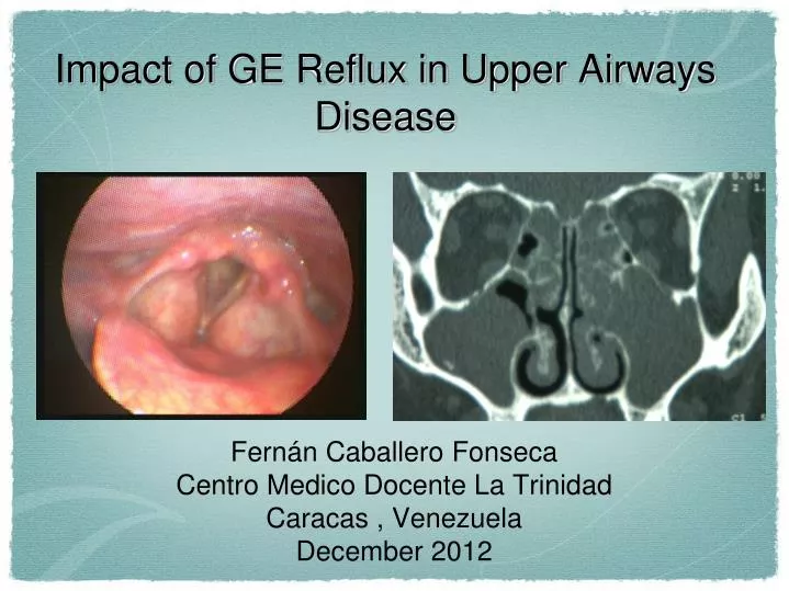 impact of ge reflux in upper airways disease