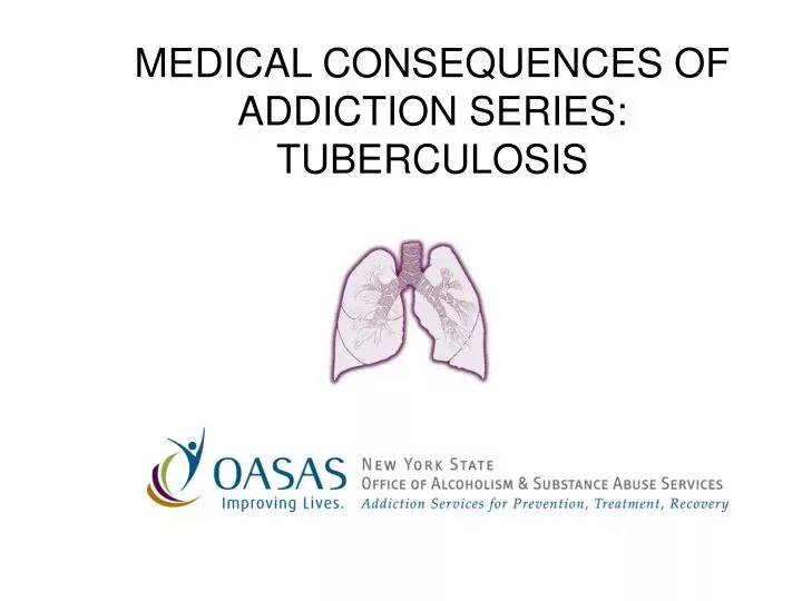 medical consequences of addiction series tuberculosis