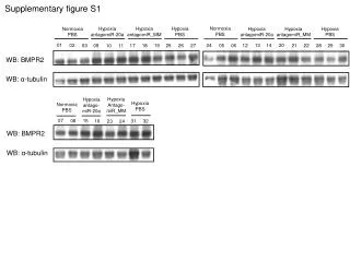 Supplementary figure S1