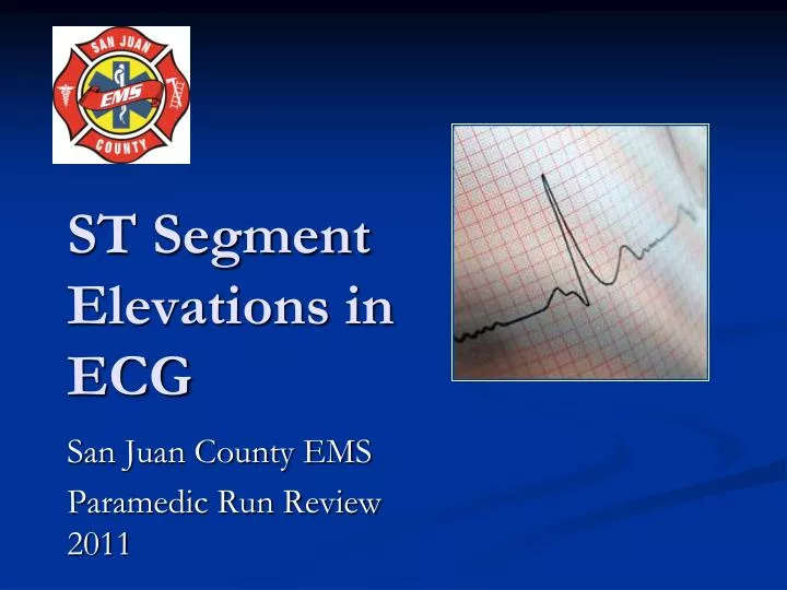 st segment elevations in ecg