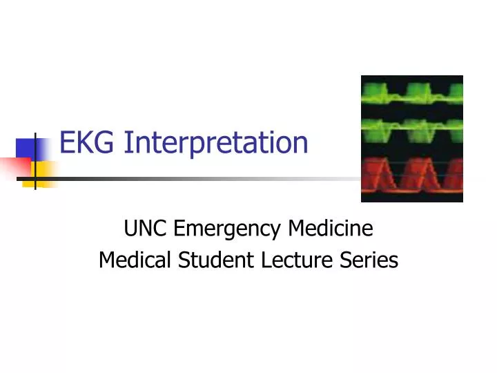 ekg interpretation