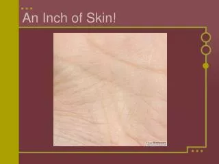 an inch of skin