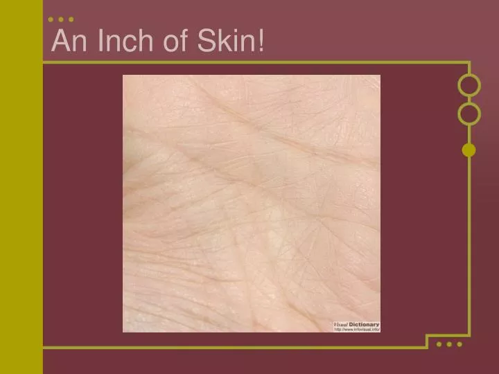 an inch of skin