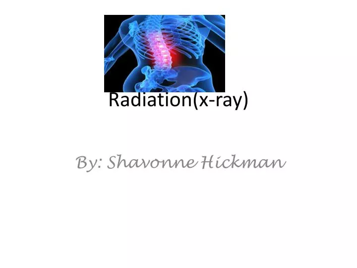 radiation x ray