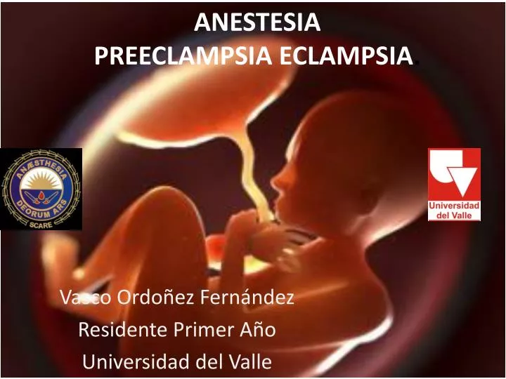 anestesia preeclampsia eclampsia