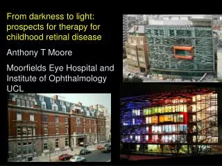 From darkness to light: prospects for therapy for childhood retinal disease Anthony T Moore