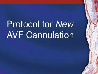 Protocol for New AVF Cannulation