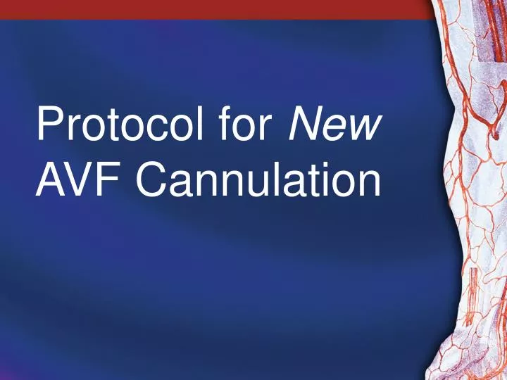 protocol for new avf cannulation