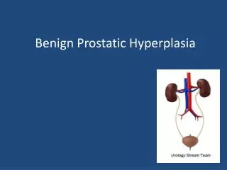 Benign Prostatic Hyperplasia