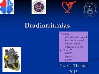 bradiarritmias