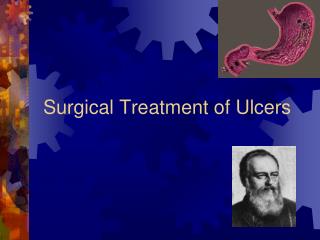 Surgical Treatment of Ulcers