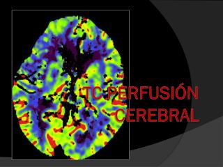 tc perfusi n cerebral