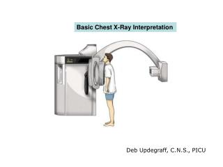 Basic Chest X-Ray Interpretation