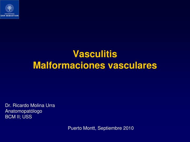vasculitis malformaciones vasculares