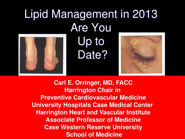 lipid management in 2013 are you up to date