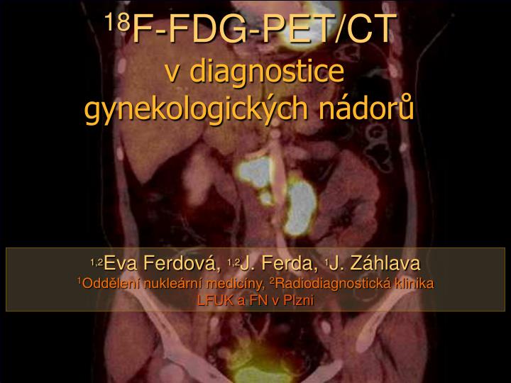 18 f fdg pet ct v diagnostice gynekologick ch n dor