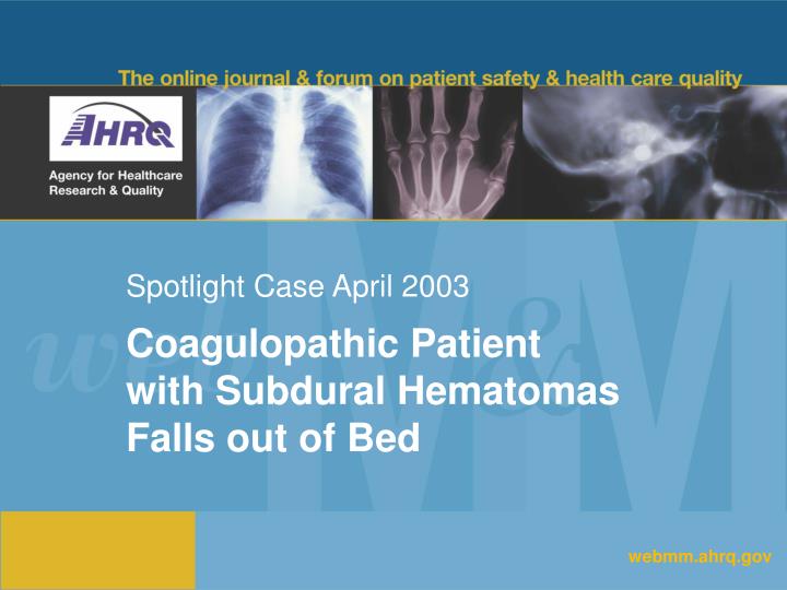 spotlight case april 2003