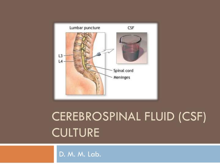 cerebrospinal fluid csf culture