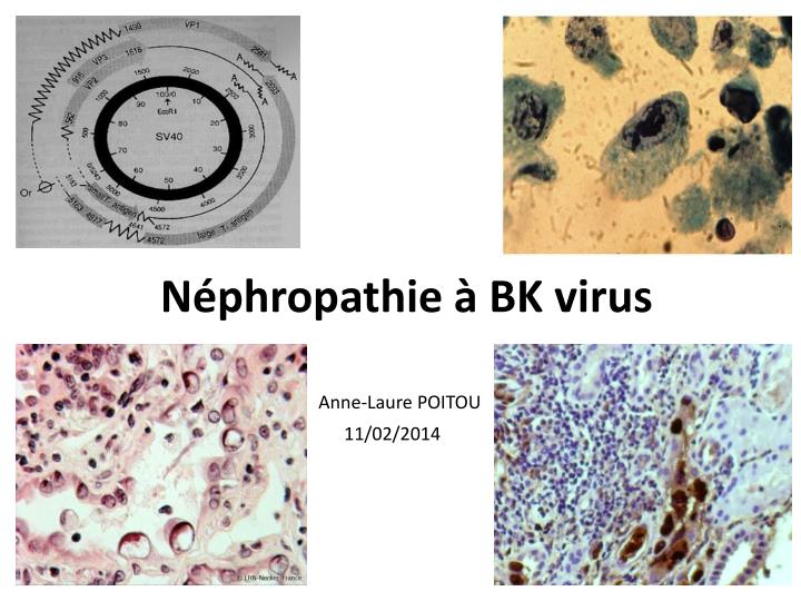 n phropathie bk virus