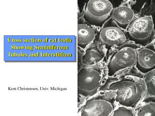 Cross section of rat testis Showing Seminiferous Tubules and Interstitium