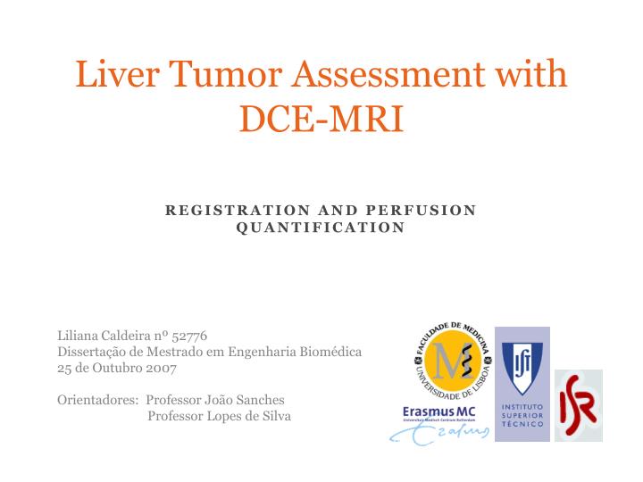 liver tumor assessment with dce mri