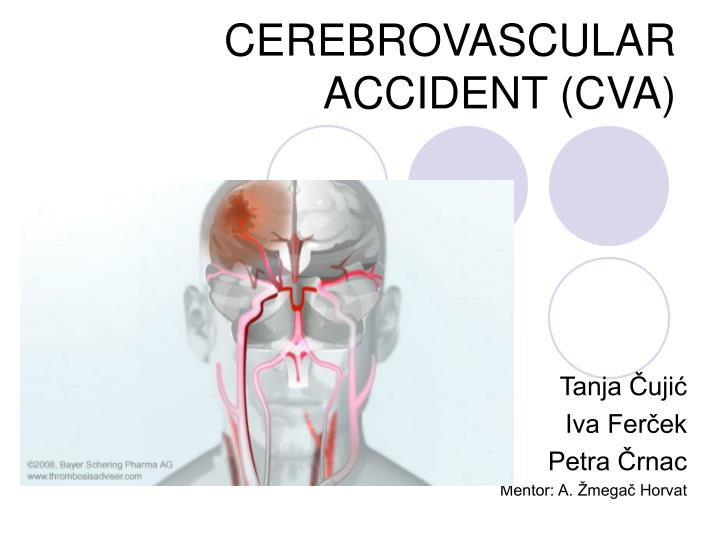 cerebrovascular accident cva