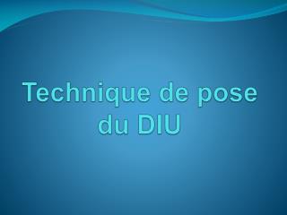 technique de pose du diu