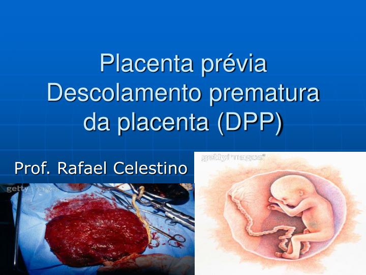 placenta pr via descolamento prematura da placenta dpp